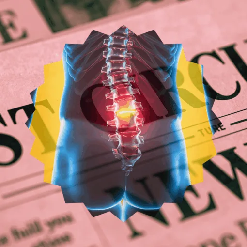 1st Circuit Spinal Cord Stimulator News headline featuring inflamed nerves in the lower back.