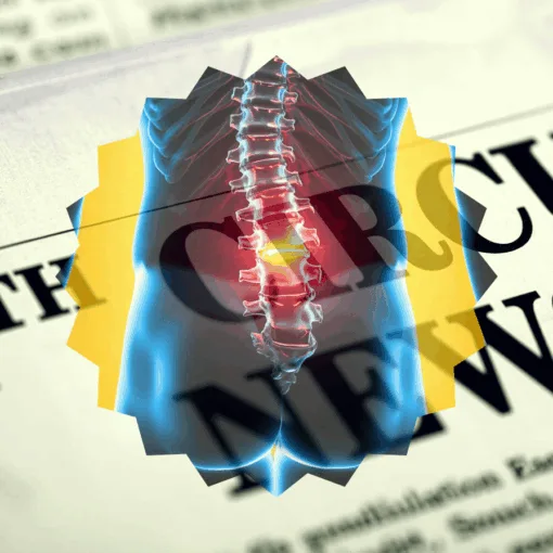 11th Circuit Spinal Cord Stimulator News headline featuring inflamed nerves in the lower back.