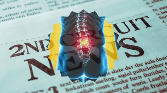 2nd Circuit Spinal Cord Stimulator News headline featuring inflamed nerves in the lower back.
