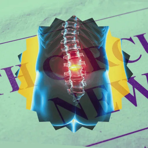 4th Circuit Spinal Cord Stimulator News headline featuring inflamed nerves in the lower back.