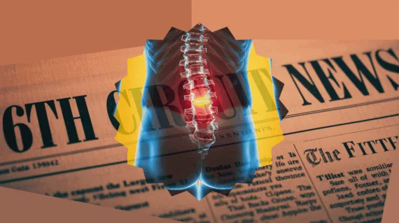 6th Circuit Spinal Cord Stimulator News headline featuring inflamed nerves in the lower back.