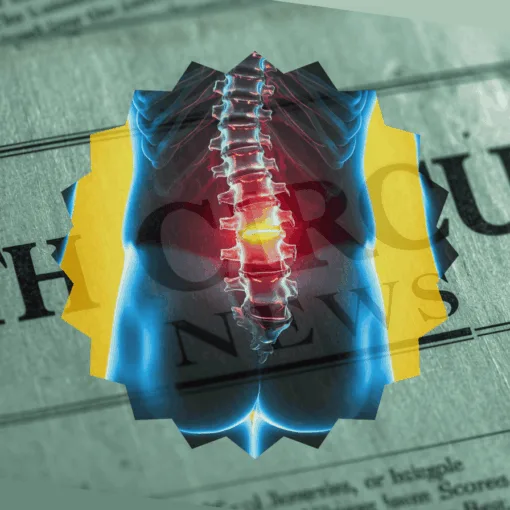 9th Circuit Spinal Cord Stimulator News headline featuring inflamed nerves in the lower back.
