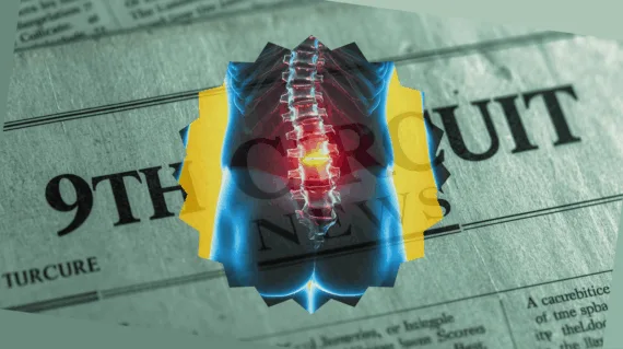 9th Circuit Spinal Cord Stimulator News headline featuring inflamed nerves in the lower back.